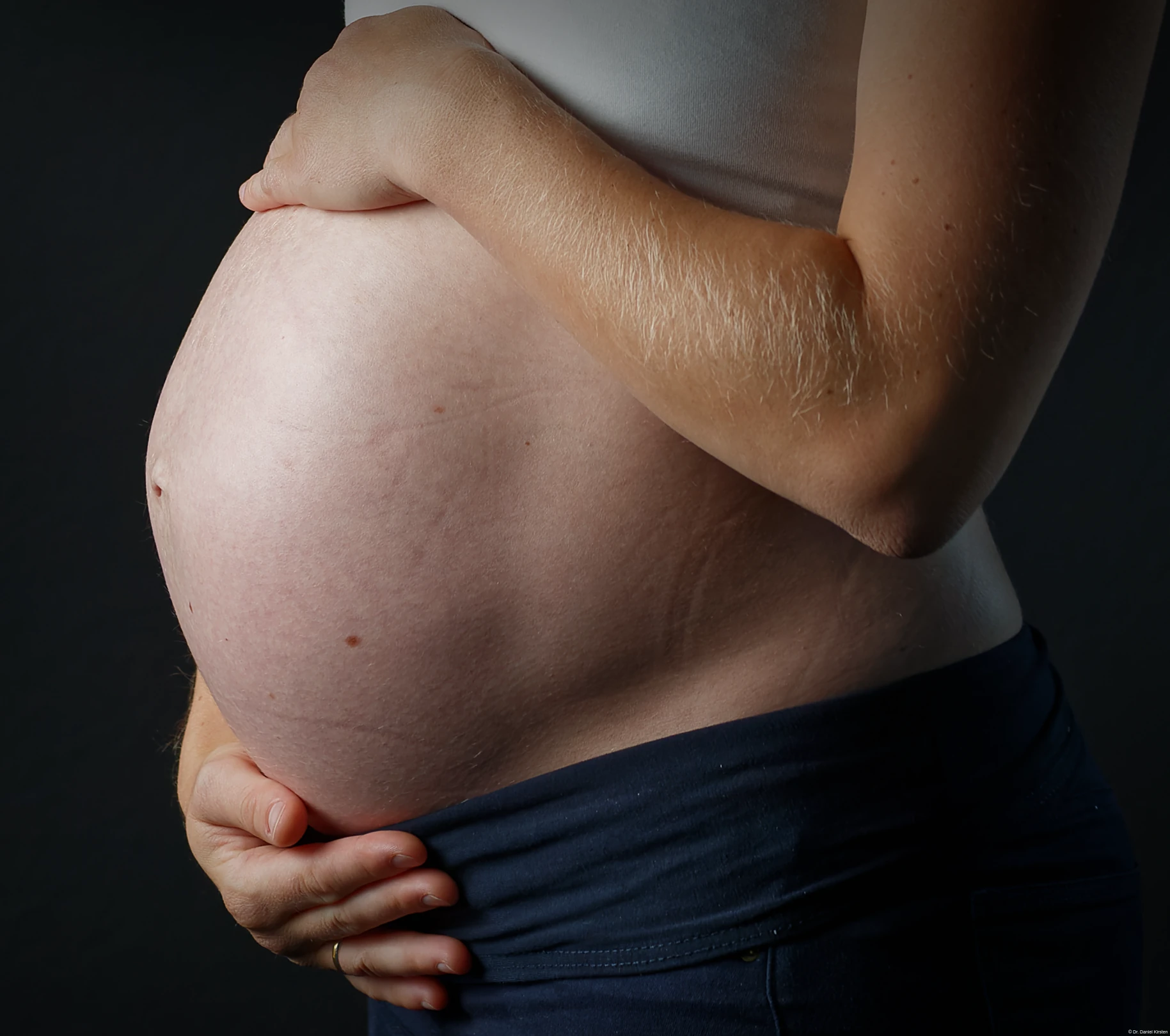 Schwangerschaftsshooting Retusche Beautyretusche Babybauch Frequenzseparierte Hautretusche